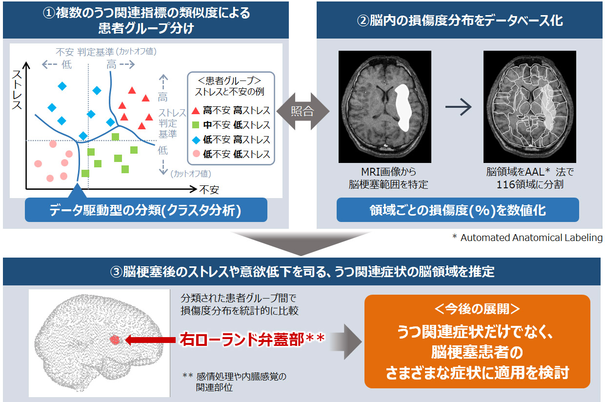 第600回 脳梗塞患者のうつ関連症状の脳領域が 右ローランド弁蓋部 であることを発見 広島大学生体システム論研究室